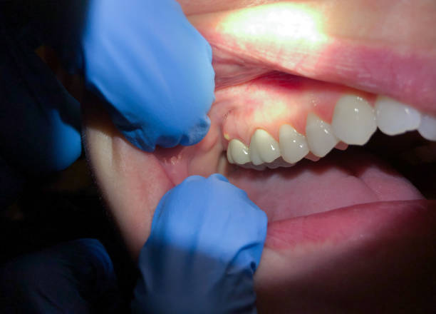 Best Cosmetic Emergency Dentistry in Beaumont, TX