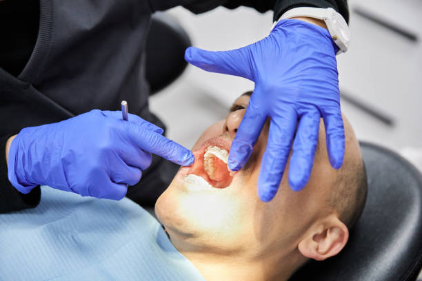 Best Emergency Treatment for Dental Infections or Abscesses in Beaumont, TX