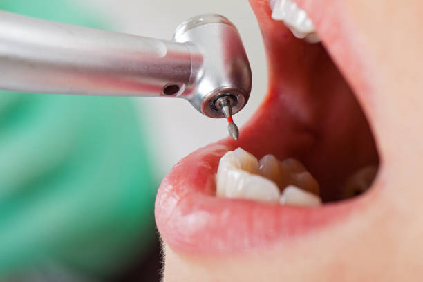 Best Same-Day Emergency Dental Services in Beaumont, TX